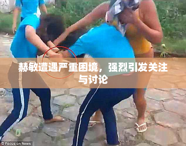 赫敏遭遇严重困境，强烈引发关注与讨论