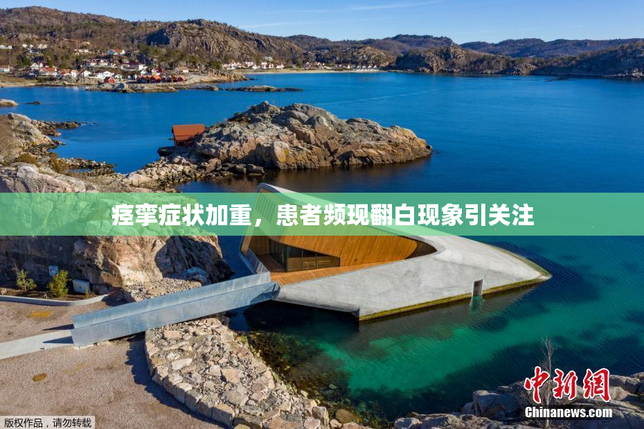 痉挛症状加重，患者频现翻白现象引关注