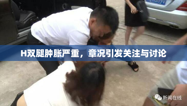 H双腿肿胀严重，章况引发关注与讨论