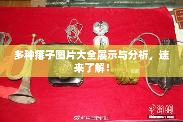 多种痱子图片大全展示与分析，速来了解！