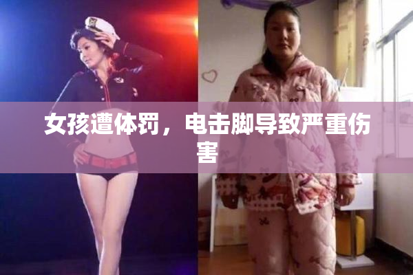 女孩遭体罚，电击脚导致严重伤害