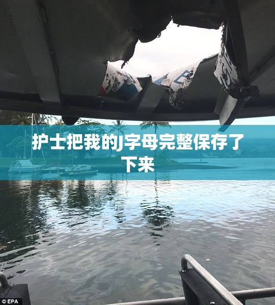 护士把我的J字母完整保存了下来