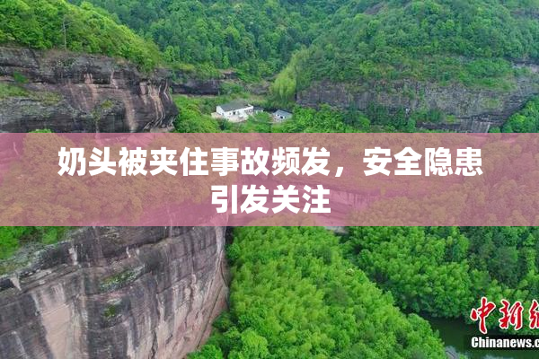 奶头被夹住事故频发，安全隐患引发关注