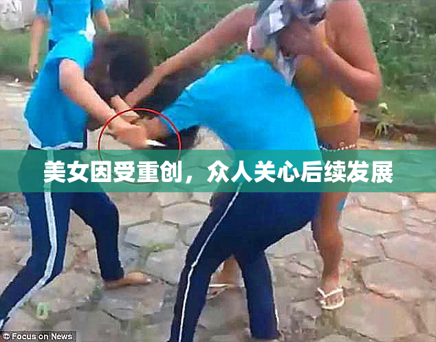 美女因受重创，众人关心后续发展