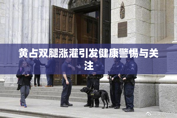 黄占双腿涨灌引发健康警惕与关注